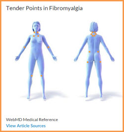 fibromyalgia